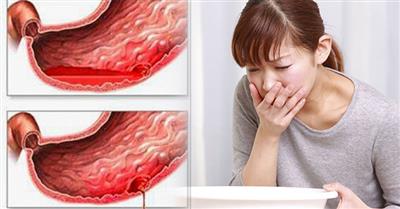 Tại sao Việt Nam có số ca bệnh dạ dày nhiều trên thế giới?